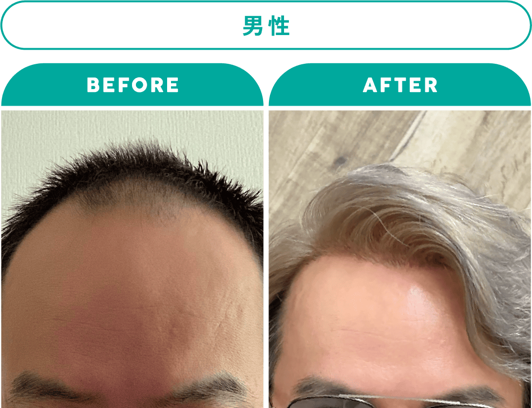 男性 症例2