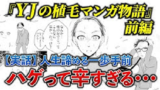 YJの植毛マンガ物語 前編