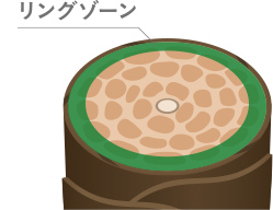 リングゾーン