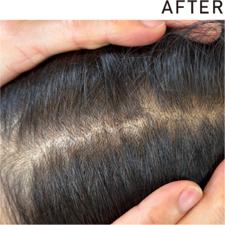 クールブラウンAFTER